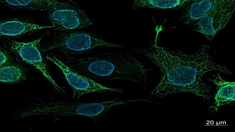 A molecular switch for feeding and fasting could hold clue to obesity and aging